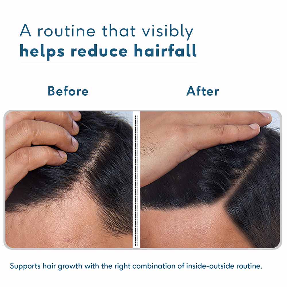 Anti-Hairfall Kit for Men