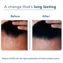 6 - HK Vitals Anti-Hairfall Kit (for Men) by HealthKart,  3 Piece(s)/Pack  Combo