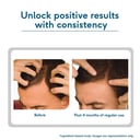 4 - HK Vitals Headful Growth Serum by HealthKart,  30 ml  All Hair Type