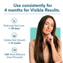 4 - HK Vitals Female Hairfall Solution,  Severe