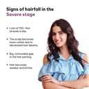 3 - HK Vitals Hair Regrowth Solution Kit,  Women  Severe