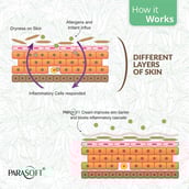 4 - Parasoft Cream for Dry Skin Paraben Free with Added Goodness of Aloe Vera,  200 g  Dry skin 