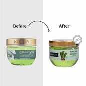 4 - Kapiva Pure Aloe Vera Gel,  150 g  for Oily and Dry Skin 