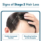 5 - HealthKart HK Vitals Hair Fall Solution,  STAGE 2
