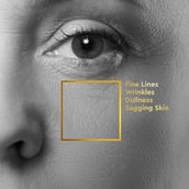 2 - VLCC Clinic ProYouth Bio Cream,  100 g  Superhydra