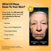 5 - Setu Skin Protect+ Powder, Strawberry 1 sachets/pack