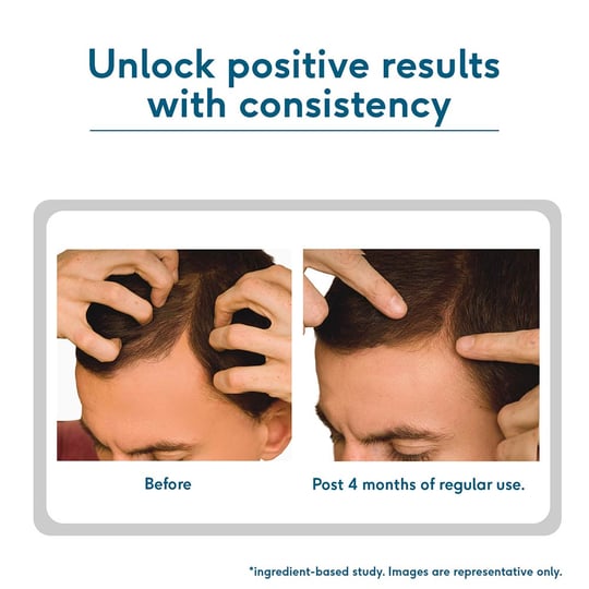 4 - HK Vitals Headful Growth Serum by HealthKart, 30 ml All Hair Type