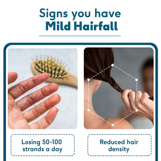 3 - HK Vitals Female Hairfall Solution,  Mild